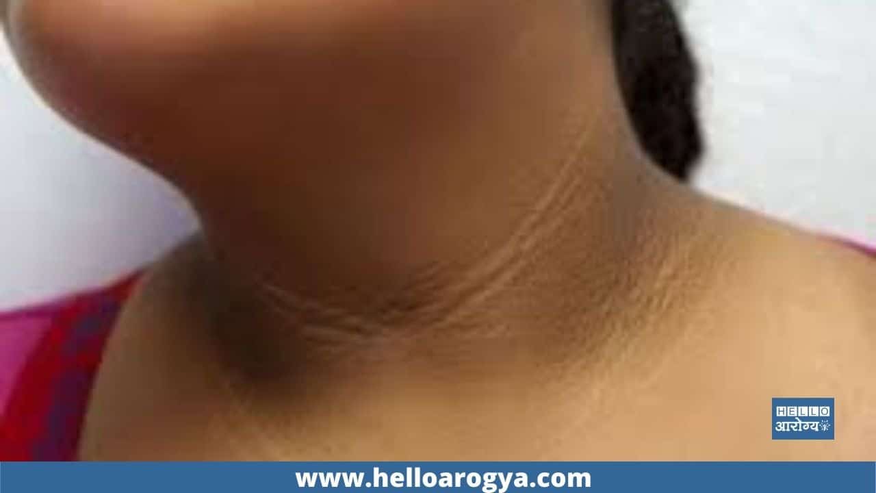 A few tips for a neck that has turned black due to constant sun